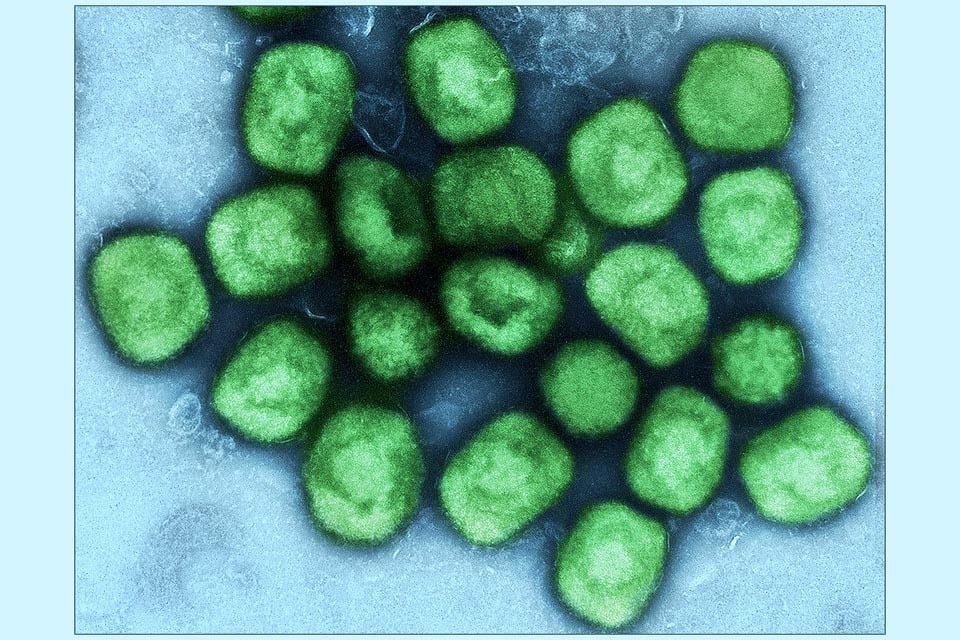 Mpox Monkeypox virus particles NIAID