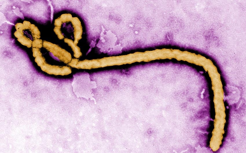 Ebola virus under an electron microscope Source US Centers for Disease Control and Prevention CDC website