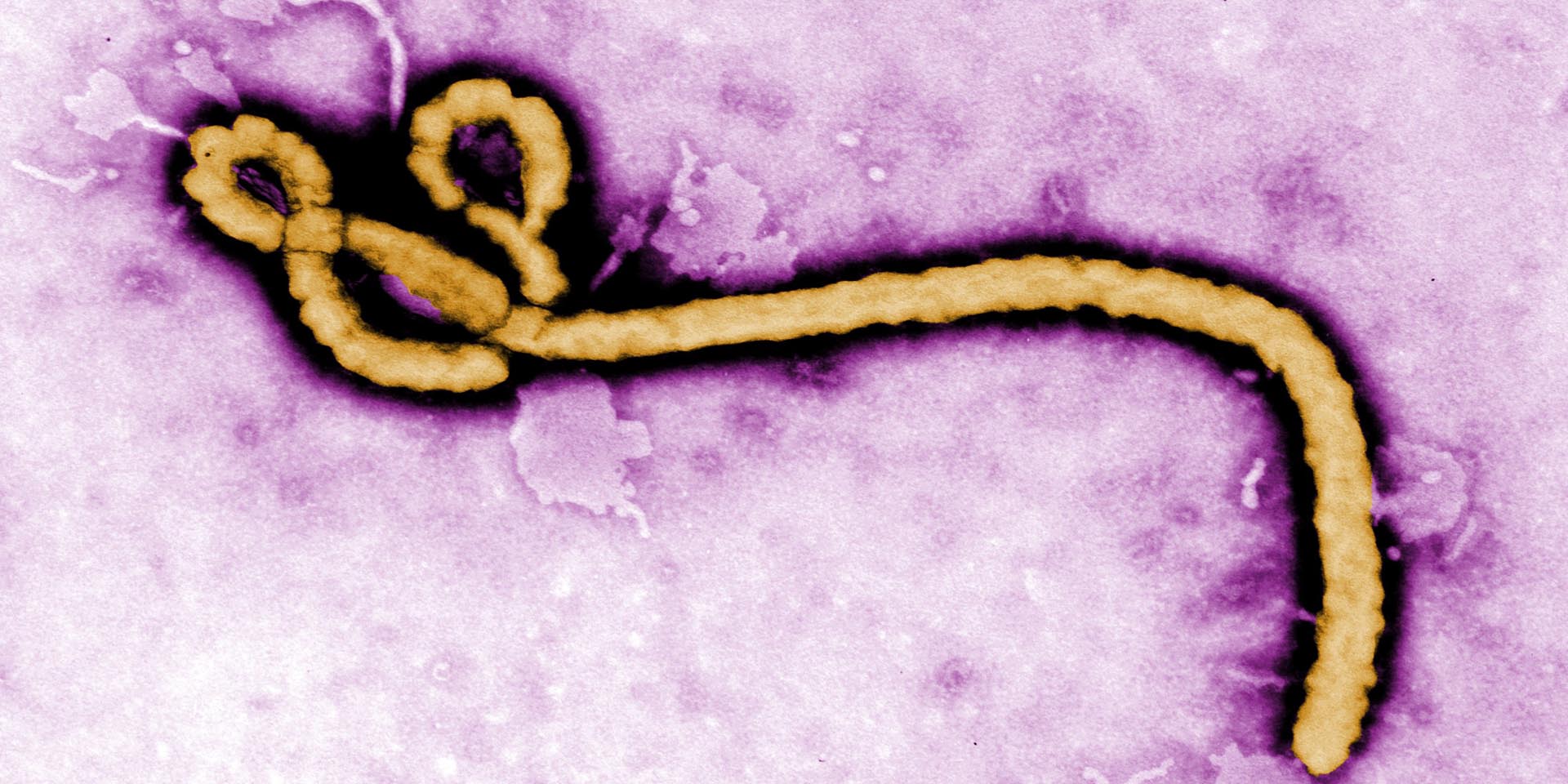 Ebola virus under an electron microscope Source US Centers for Disease Control and Prevention CDC website